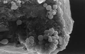 Scanning electron microscope image of nanoparticles on a grain of sand